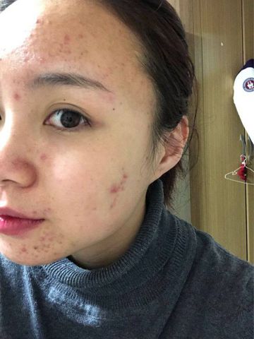 Bạn Nữ ... Độc thân 36 tuổi Tìm bạn tâm sự ở TP Tuyên Quang, Tuyên Quang